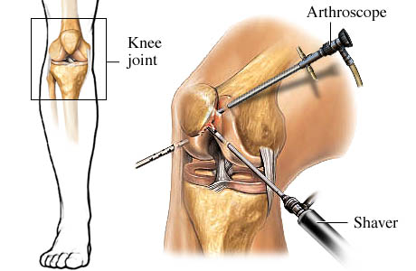 Orthopaedic Surgeon In Nashik